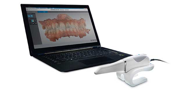 CS 3600 / Carestream Dental - Scanner intra-oral de l’orthodontie numérique