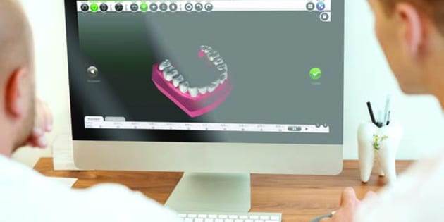 Solution 3D et traitements par gouttières d’alignement