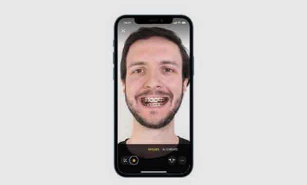 Smile Mate et Vision outils numériques