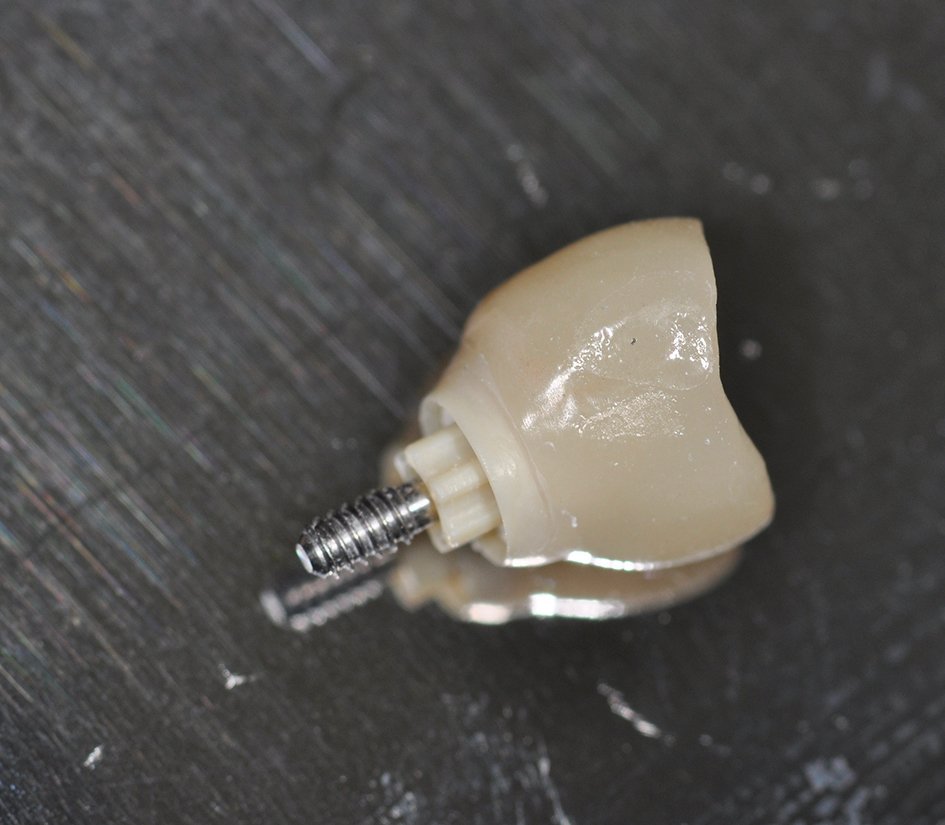 Connectique prothétique hexalobée sur implant Ceralog.