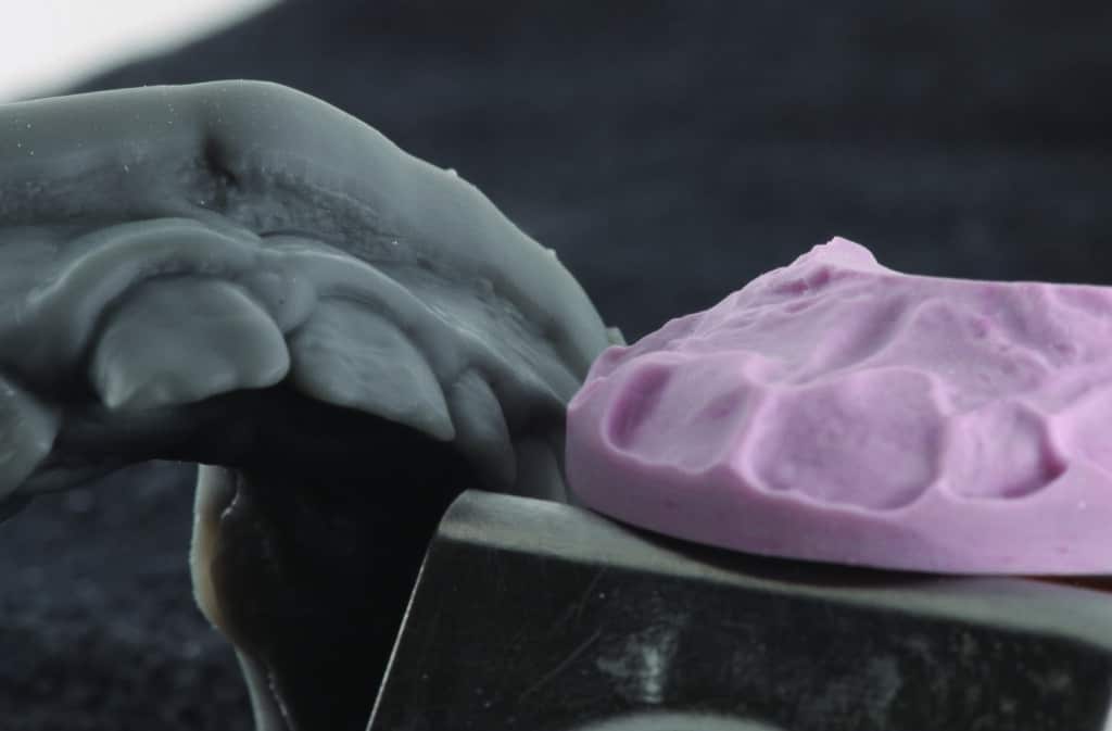 Modèle en résine imprimé à partir du wax-up virtuel et clé en silicone.