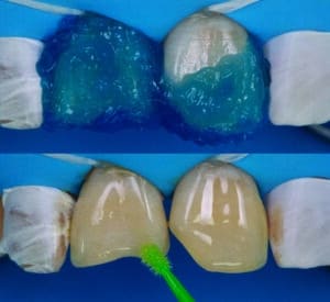 composites stratifiés
