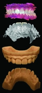 wax-up