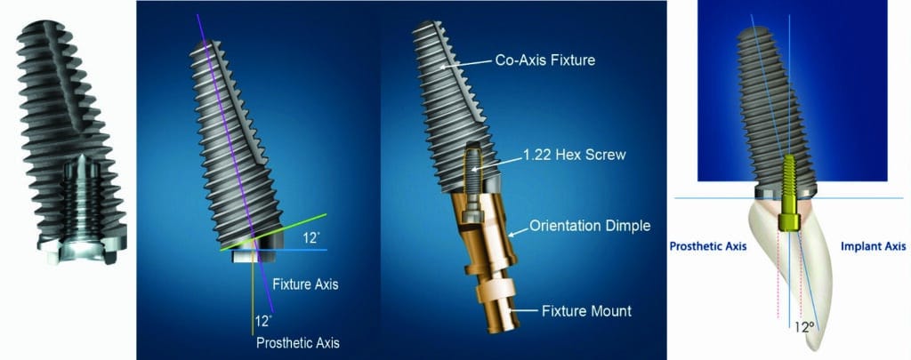 Concept et design implantaire Coaxis