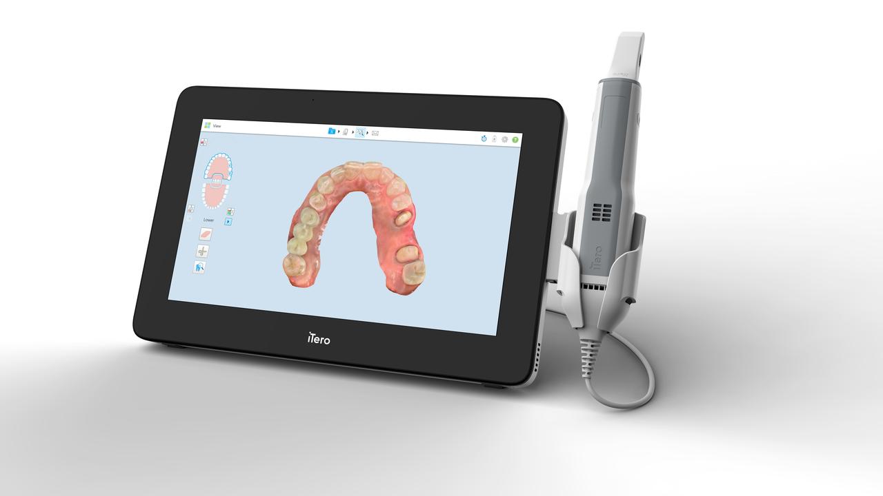 Pourquoi le scanner intra-oral est désormais plus important que jamais dans la dentisterie