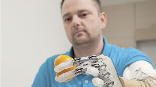Une prothèse rend le sens du toucher à un homme amputé de la main