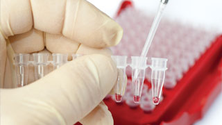 Traitement ciblé contre le cancer : la piste des nanoparticules « intelligentes »