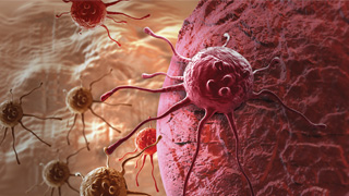 Comprendre et dépasser le phénomène de résistance aux traitements des cellules cancéreuses Comprendre et dépasser le phénomène de résistance aux traitements des cellules cancéreuses