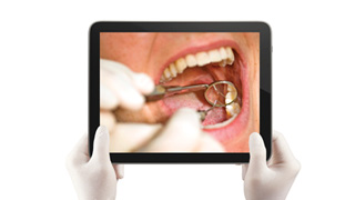 La première e-consultation dentaire de France La première e-consultation dentaire de France