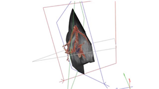 Imagerie médicale : les ultrasons au service d’une meilleure lecture