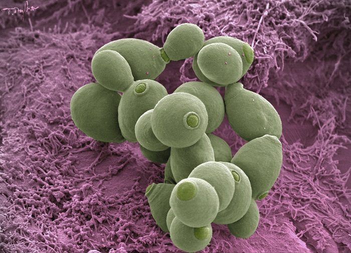 La dysbiose post-antibiotique