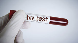 Un volet biologique consacré au dépistage du VIH et des hépatites B et C