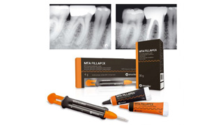 DENTALDCP – MTA FILLAPEX