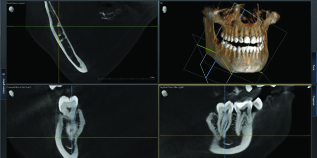Dentsply Sirona – Deux solutions d’imagerie mises à jour
