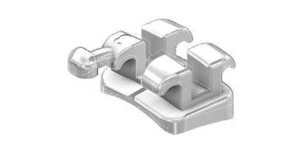 Forestadent france – une optimisation du design des brackets mini sprint deuxième génération