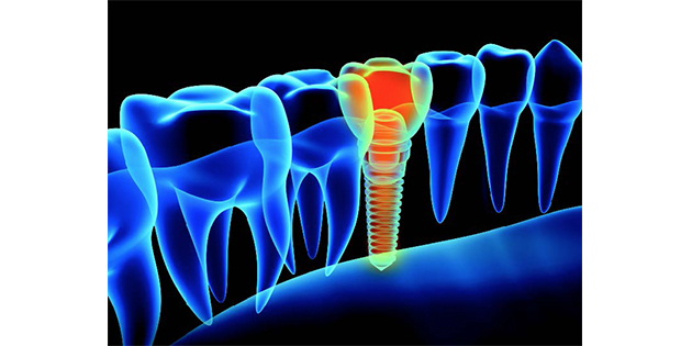 Best of Implantology : les sujets incontournables