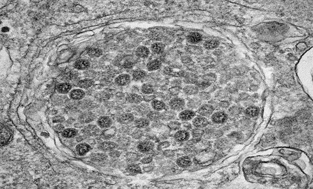 Covid-19 : nouveau test sérologique