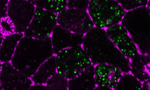 Covid-19 : la réponse trop tardive des cellules infectées