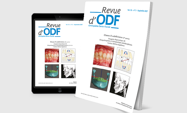 La Revue d’ODF – N°55-3 : Classe II subdivision (2e partie)
