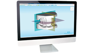 STAND JO : M01. ORTHOX – Scanner de modèles 3D