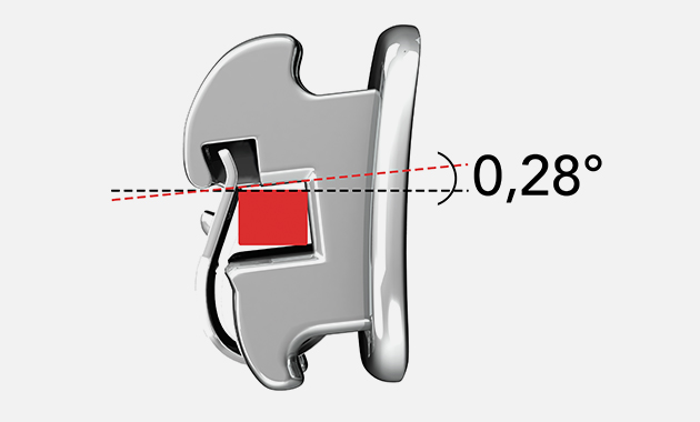 Technique TGO/GET pour le contrôle du torque