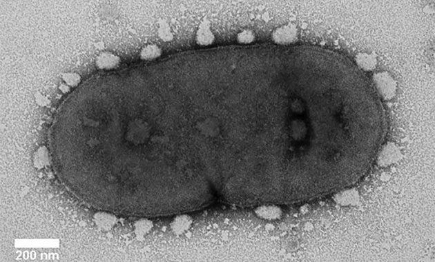 Implication de la maladie parodontale sur la santé de nos patients : mythe ou réalité ?