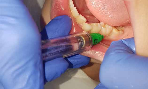 Anesthésie dentaire : ergonomie et modernité