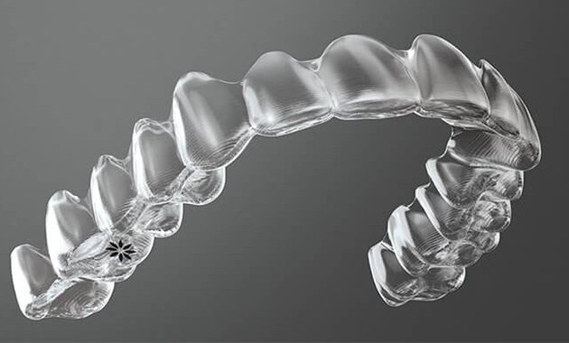 Invisalign lance Smartrack