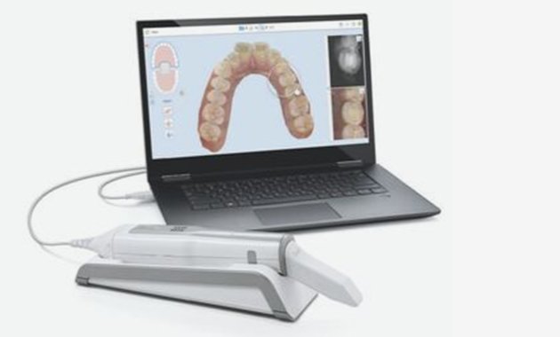 Une nouvelle fonctionnalité pour le système Itero Element 5D