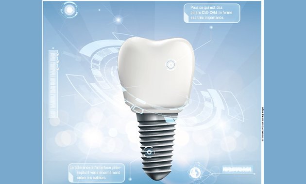 L’empreinte optique en implantologie
