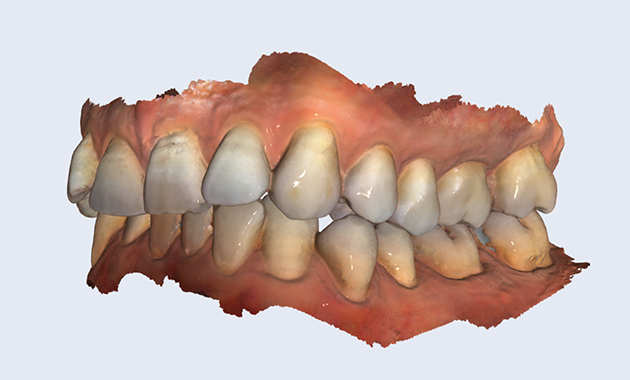 Nouvelle application de transfert d’images Planmeca Romexis LabApp