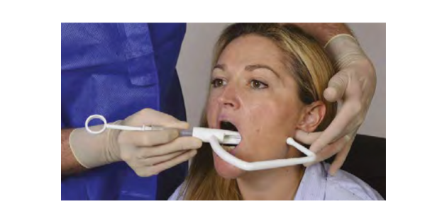 Dentalgic : EZ BLOCK, la réussite des anesthésies mandibulaires
