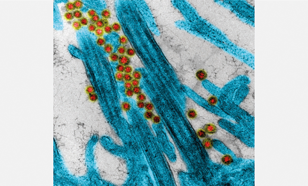 Covid-19 : trois fois plus de décès que la grippe saisonnière