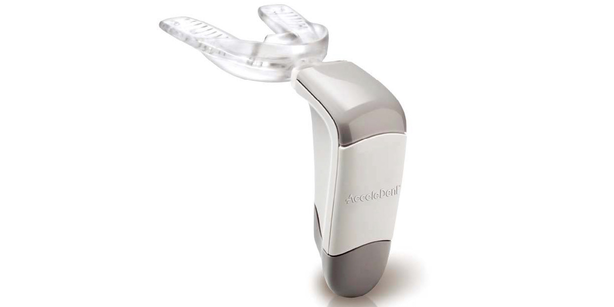 Acceledent, innovation dans les traitements d’orthodonties, poursuit son développement en Europe et en France