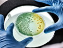 Une nouvelle méthode fiable et rapide pour détecter les bactéries vivantes