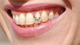 Le tatouage dentaire : une nouvelle tendance en vogue