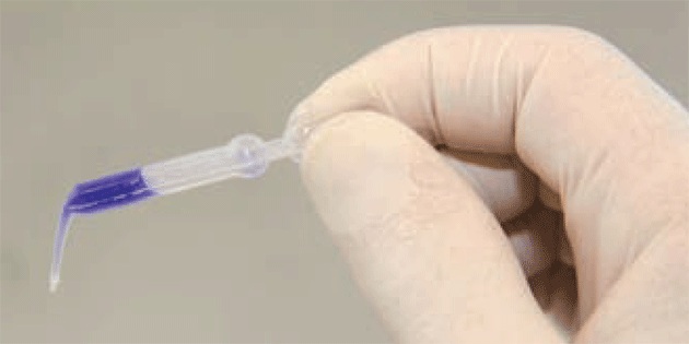 Periacryl par Armatys – La colle qui simplifie les procédures chirurgicales Periacryl par Armatys – La colle qui simplifie les procédures chirurgicales