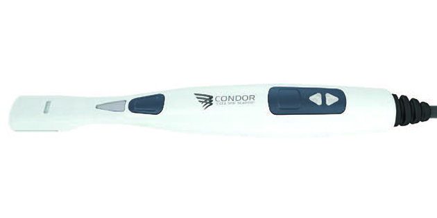 Scanner intra-oral Condor de Biotech : le numérique à portée de main