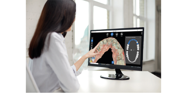 Carestram Dental – CS Scan Flow : la numérisation intra-orale entre dans une nouvelle dimension