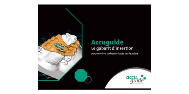 Forestadent : Accuguide, le gabarit d’insertion pour mini-vis orthodontiques sur le palais. Forestadent : Accuguide, le gabarit d’insertion pour mini-vis orthodontiques sur le palais.