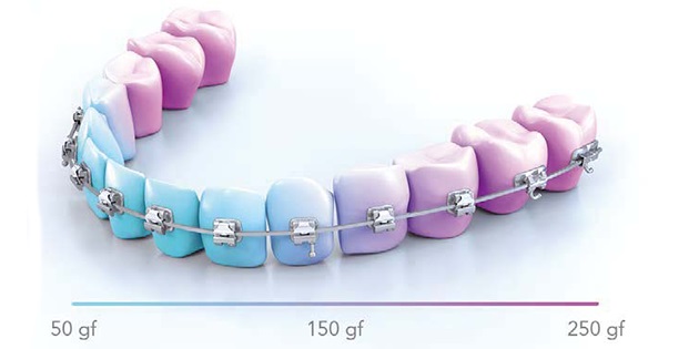 1 pièces matériel dentaire orthodontique C Type de – Grandado