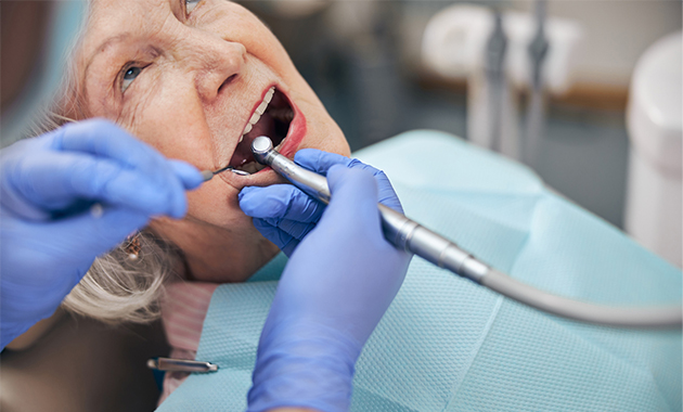 Seniors : Quand la dentition entrave la nutrition