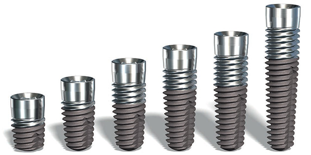 Nouveaux implants Legacyp/Implant Direct : filetage progressif en V pour une stabilité primaire renforcée