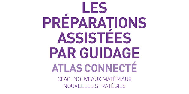 Tribune libre ”Jacques Raynal : Les préparations assistées par guidage” – Cerec Touch