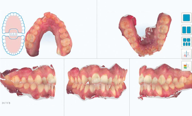 Le numérique appliqué à l’orthodontie