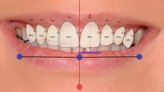 PLANMECA – LOGICIEL ROMEXIS SMILE DESIGN