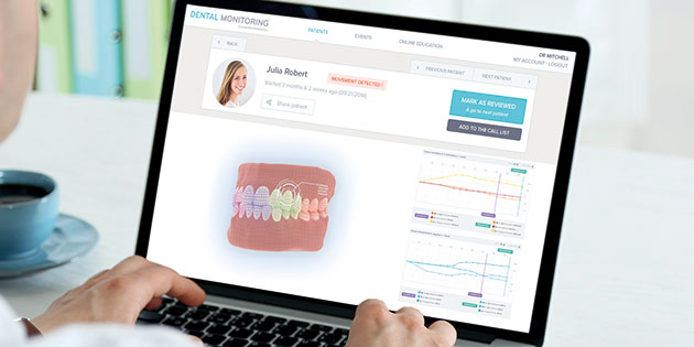 Dental Monitoring Photo/RMO Europe : le monitoring avec une nouvelle gamme DM