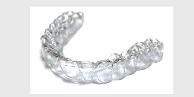 Première solution de suivi dynamique des aligneurs : DM GoLive par RMO-Dental Monitoring Première solution de suivi dynamique des aligneurs : DM GoLive par RMO-Dental Monitoring