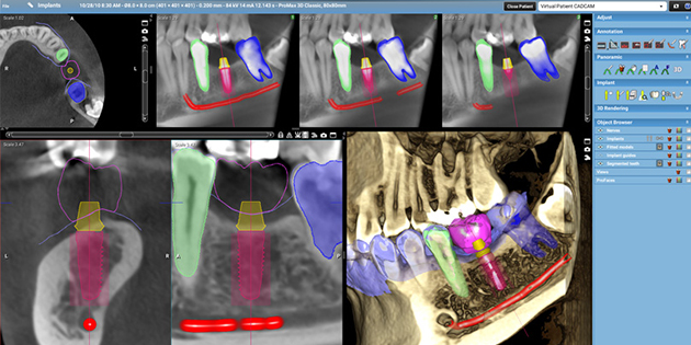 Planmeca Romexis 3D Ortho Studio