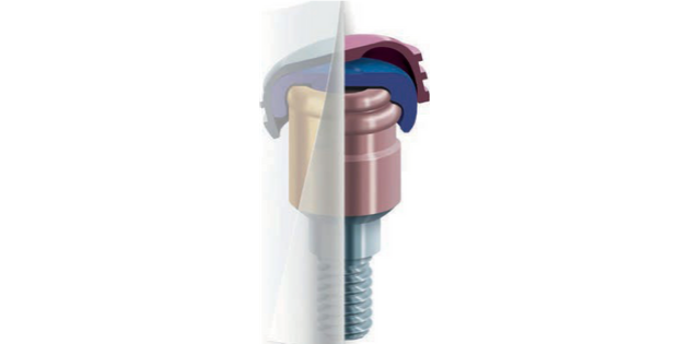 Le système de fixation amovible locator r-tx Le système de fixation amovible locator r-tx